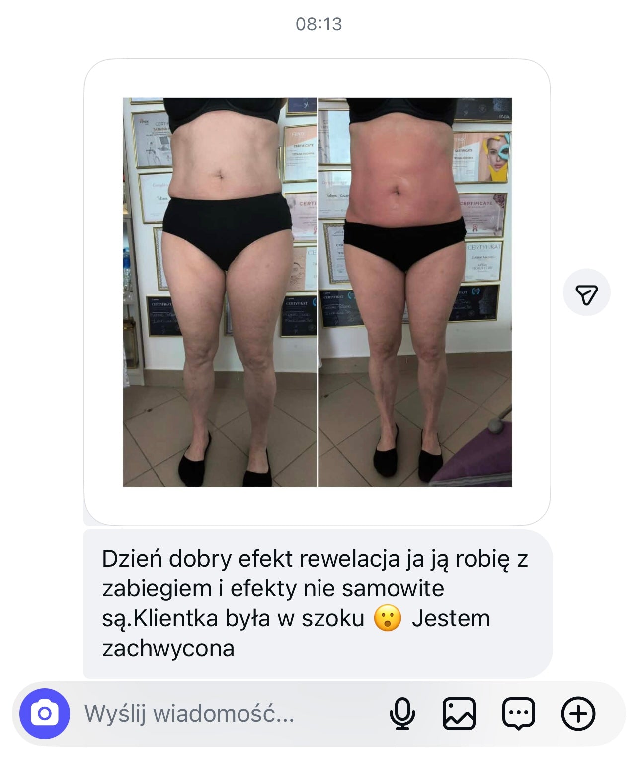 Cool&amp;Hot Belly Mask (firming the belly and sides)